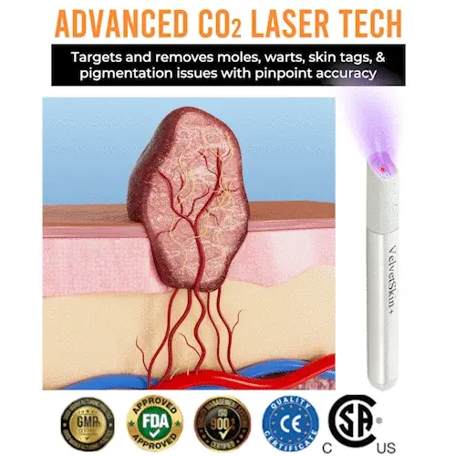Hopearve™ All-in-One CO₂ Laser Eraser Pen | Removes Moles, Warts, Skin Flaws & Pigmentation