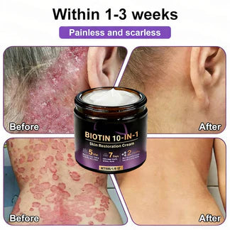 Made and Shipped from USA ✨Hopearve® Biotin 10-in-1 Skin Restoration Cream 🍀