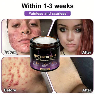 Made and Shipped from USA ✨Hopearve® Biotin 10-in-1 Skin Restoration Cream 🍀