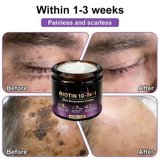 Made and Shipped from USA ✨Hopearve® Biotin 10-in-1 Skin Restoration Cream 🍀