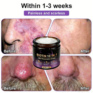 Made and Shipped from USA ✨Hopearve® Biotin 10-in-1 Skin Restoration Cream 🍀