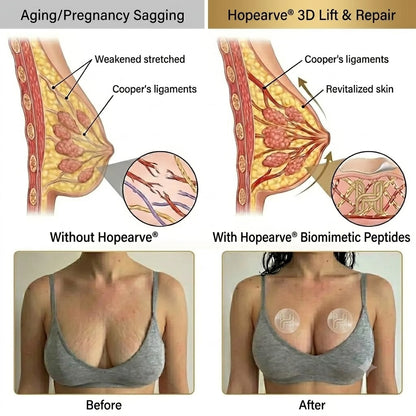 🔥Limited-time 60% sale--Hopearve Targeted Breast Enhancement Advanced Nano-Microneedle Patches