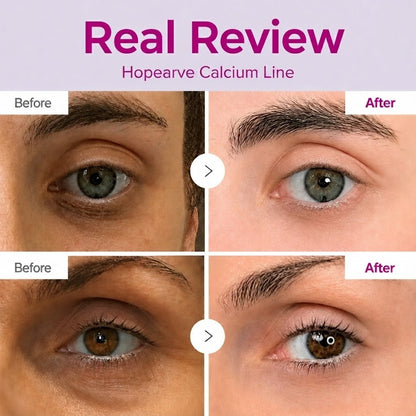 🔥LAST DAY 50% OFF!!Hopearve Korean Calcium Dark Spot Eye Cream