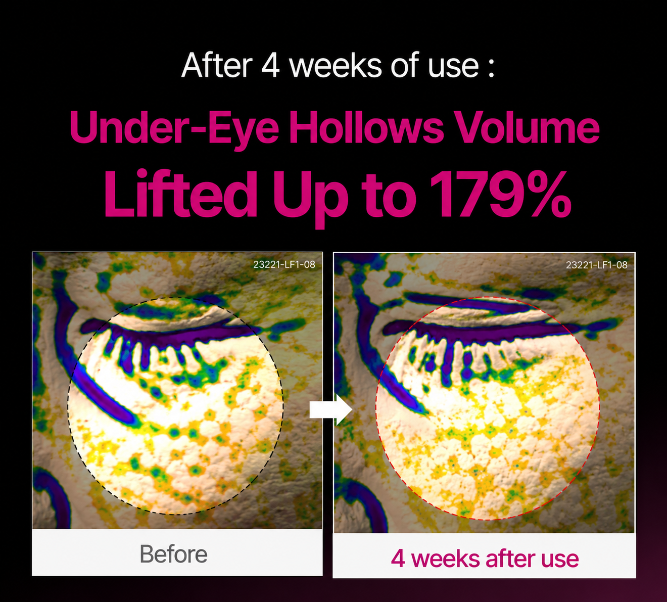 🔥LAST DAY 50% OFF!!Hopearve Korean Calcium Dark Spot Eye Cream